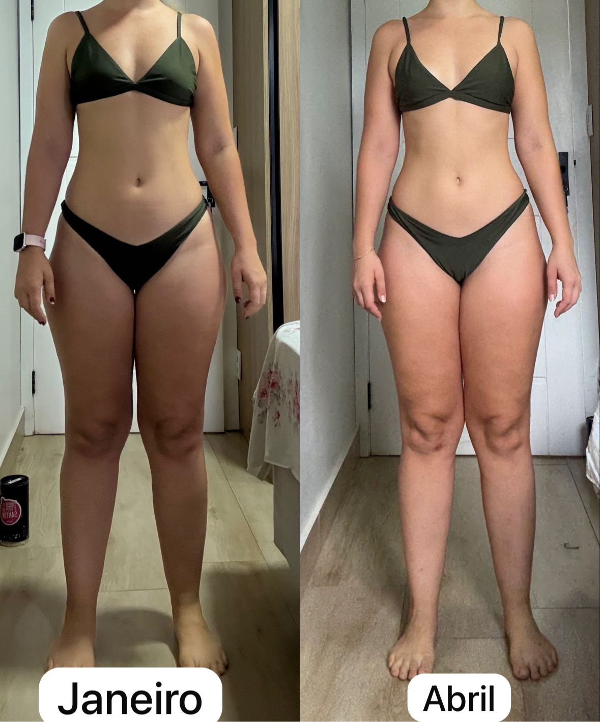 Transformação de paciente — frontal, antes e depois do Método Essência