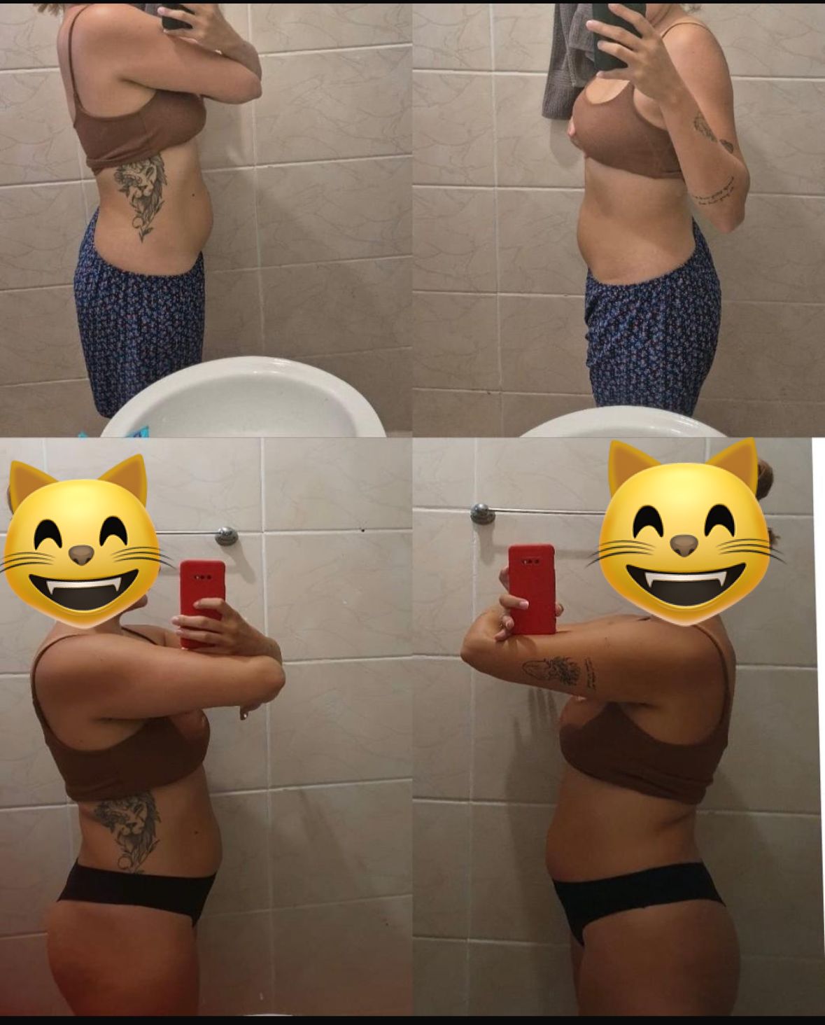 Transformação de paciente — antes e depois do Método Essência